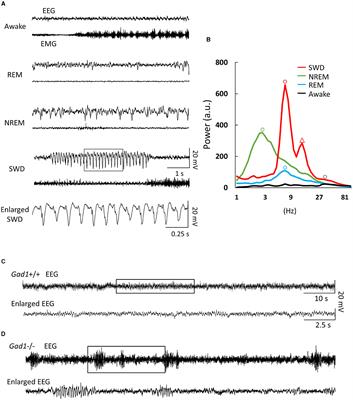 Gad1 knock-out rats exhibit abundant spike-wave discharges in EEG, exacerbated with valproate treatment